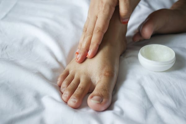 Talons secs et crevassés : la remise en état d'octobre avant les chaussures fermées